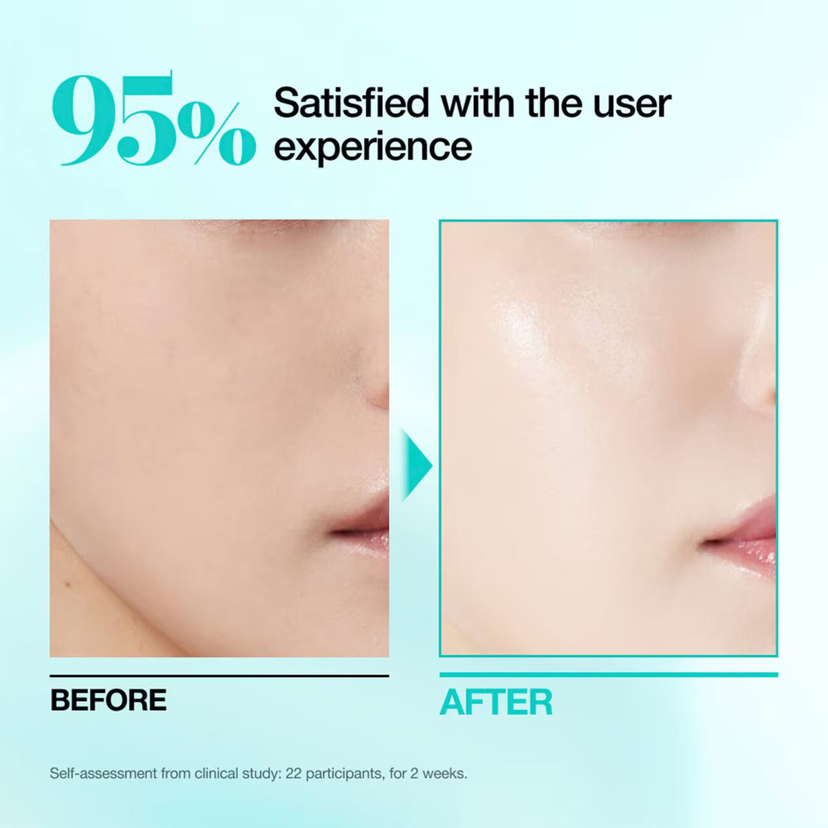 Anua PDRN Hyaluron Capsule 100 Serum Mask (23ml × 1 Sheet)
