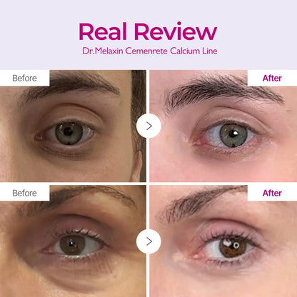 Dr. Melaxin Cemenrete Calcium Eyecare Routine
