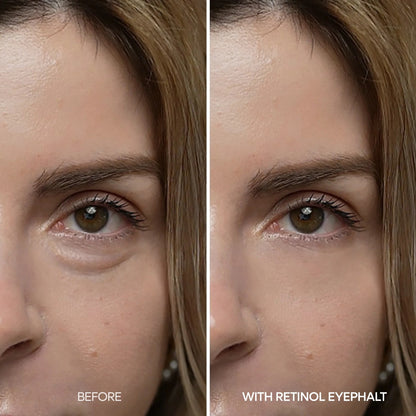 Dr. Melaxin Day&Night Care Eyephalt Eyebag Lifting Line