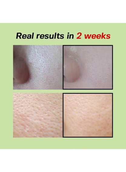 SUNGBOON EDITOR Green Tomato Pore Zero Ampoule+ 40ml
