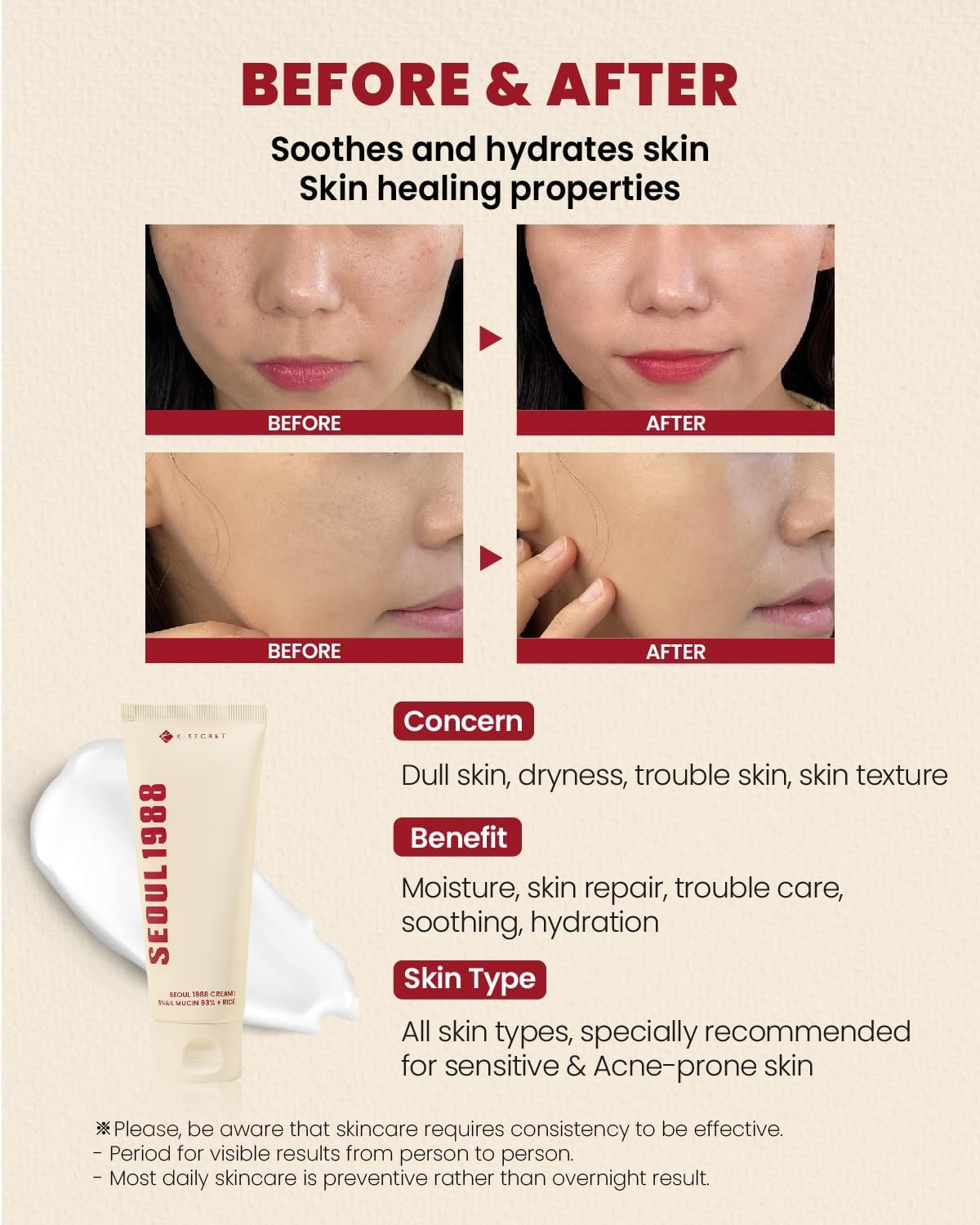 K-SECRET SEOUL 1988 Cream : Snail Mucin 93% + Rice
