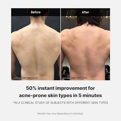 MEDICUBE Red Acne Body Wash 2.0 – Clarify & Calm Body Cleanse - 400 g