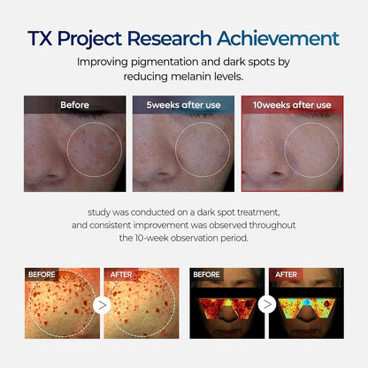 DR.Melaxin TX Tranexamic Acid Cream - 50 ml