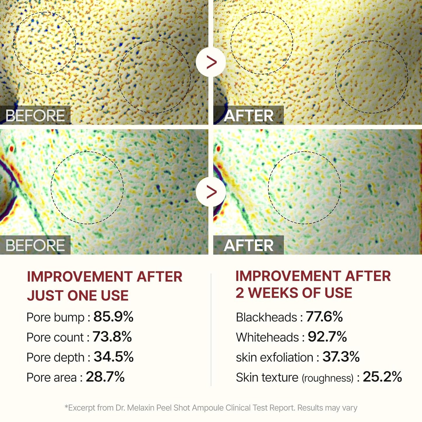 Dr. Melaxin Peel Shot Glow Black Rice Peeling Ampoule - 80 ml