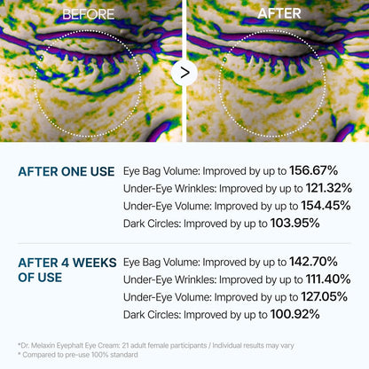 Dr. Melaxin Eyephalt Eyebag Cream - 10ml