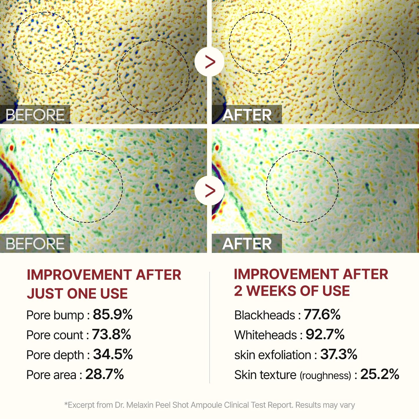 Dr. Melaxin Peel Shot Glow White Rice Peeling Ampoule - 80ml