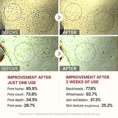 Dr. Melaxin Peel Shot Glow White Rice Peeling Ampoule - 80ml