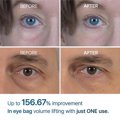 Dr. Melaxin Eyephalt Eyebag Cream - 10ml